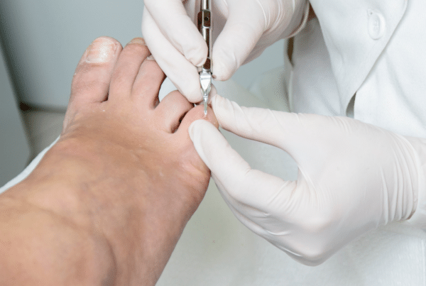 Nagelkorrektur in Walsrode